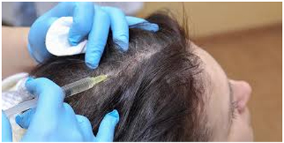 Acne Treatment in Coimbatore