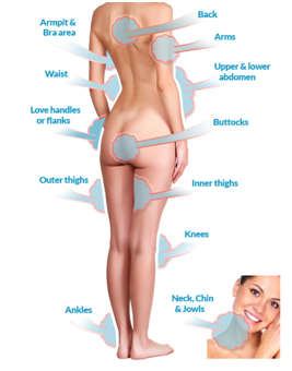 Liposuction in Coimbatore