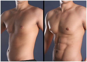 Six Pack Creation in Coimbatore