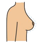 Breast Reduction Treatment