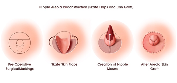 Plastic Surgeon in Coimbatore